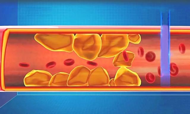 比糖和鹽更“可怕”的調(diào)味劑，我們可能每天都在吃！怪不得三高、肥胖等找上門
